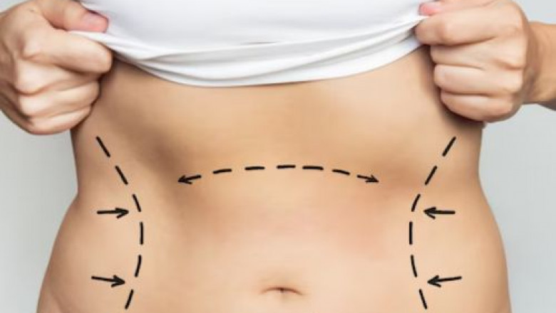 Top 5 Gynecology Cosmetic Clinics to Consider This Year