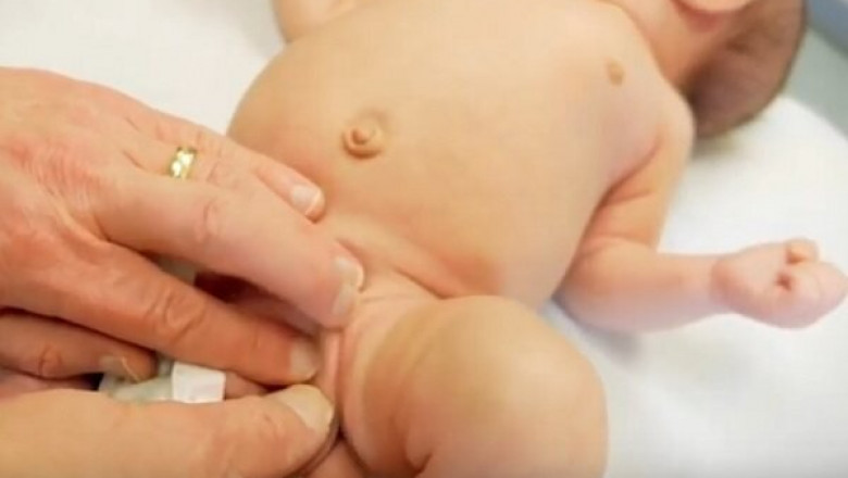 Central Precocious Puberty Market Set to Expand with Digital Therapeutics