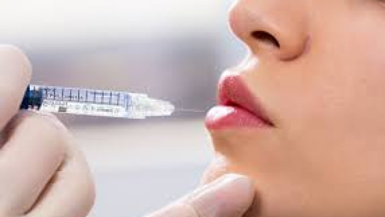 Dermal Fillers for Cheeks, Restoring Volume and Definition