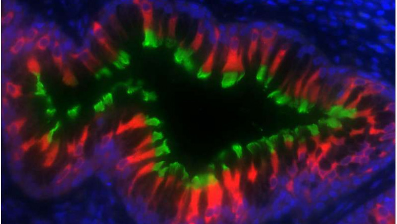 Primary Ciliary Dyskinesia Market to Grow Rapidly Owing to Gene Therapy Advances
