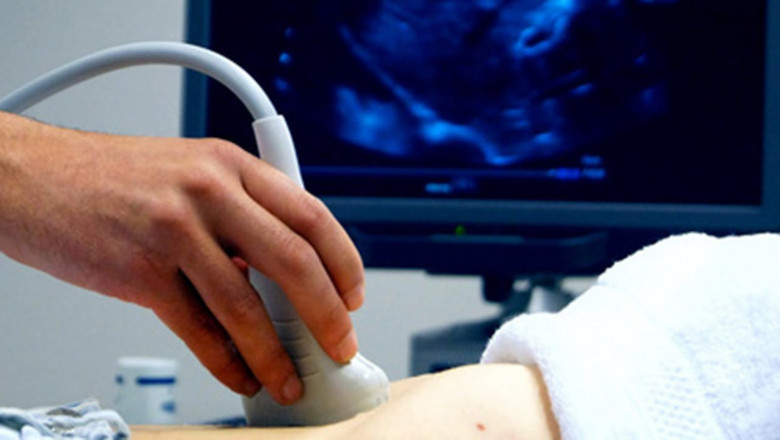What is Doppler Ultrasound and How Does it Work?
