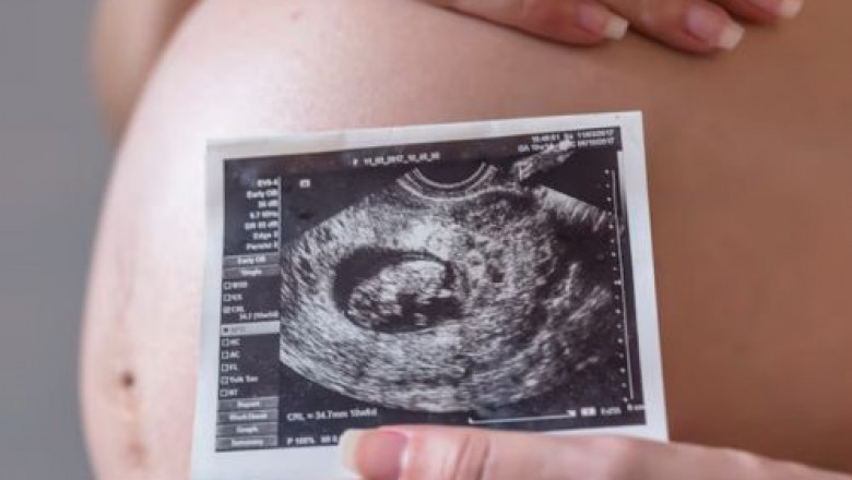 What's the Difference Between Sonography and Ultrasound?