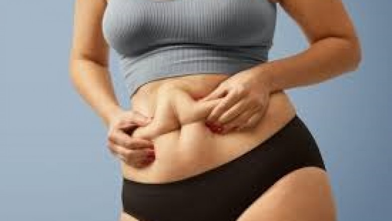 A fit body starts here - Liposuction in Riyadh