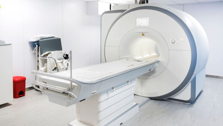 Global Full-Body Scanner Market Size, Share, Forecast 2023 - 2033