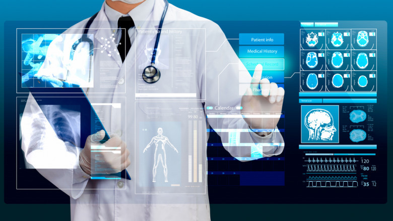 Revolutionizing Healthcare in the Andes: The Adoption of Artificial Intelligence (AI) in Diagnostic Image Analysis in Peru