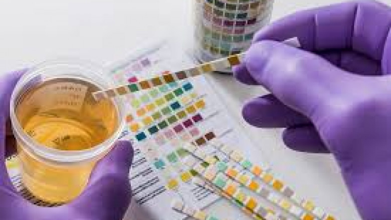 Choosing the Right Drug Testing Partner: Key Considerations for Safety Managers