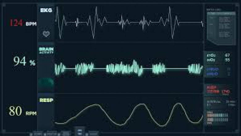 Electrocardiograph (ECG) Market Technological Innovations Transforming Hospital-Based Cardiac Care Equipment
