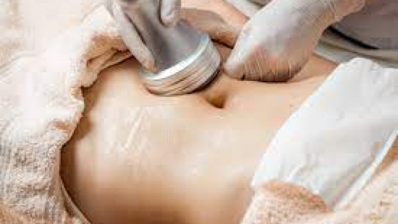 How Does Laser Treatment Help with Cellulite?
