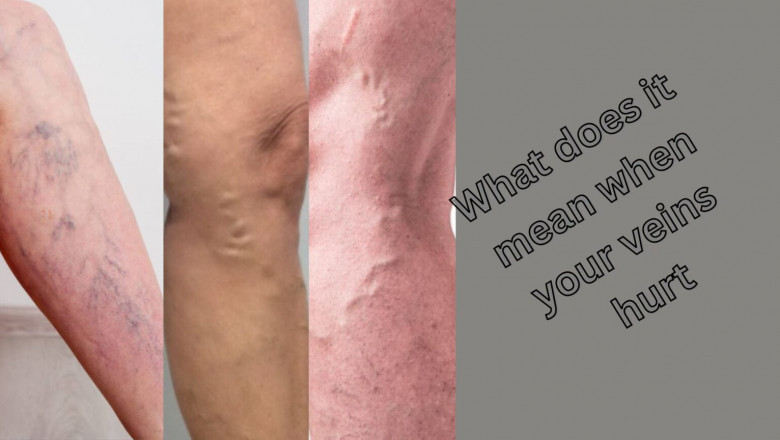What does it mean when your veins hurt?