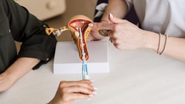 Who Should Consider Gynecologic Cosmetic Procedures?