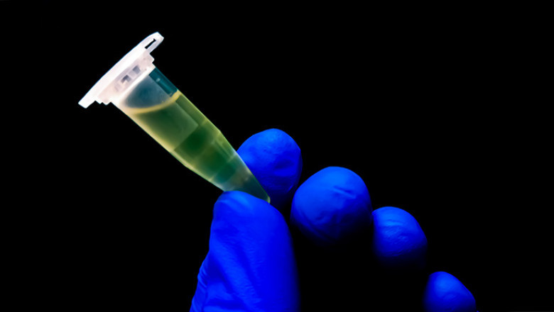 Cerebrospinal Fluid Management Market Set to Expand with Innovative Drainage Technology