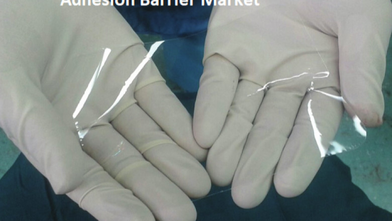 Exploring Global Adhesion Barrier Market Size with Medical Trends and Forecast Insights