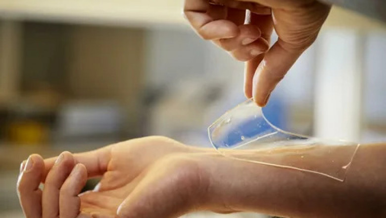 Global Alginate Dressing Market to Grow Amid Rising Wound Incidence