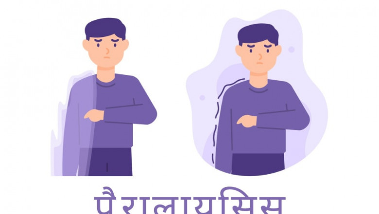 Paralysis Meaning in Hindi: Causes, Symptoms, and Treatment