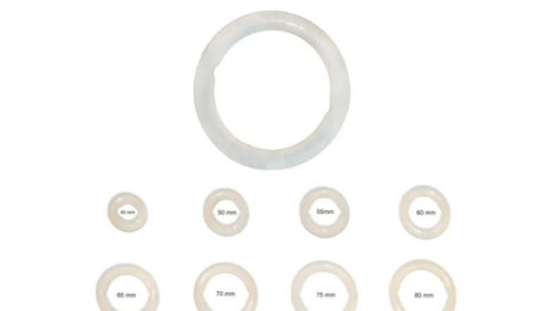 Ring Pessary for Prolapse: Non-Surgical Relief