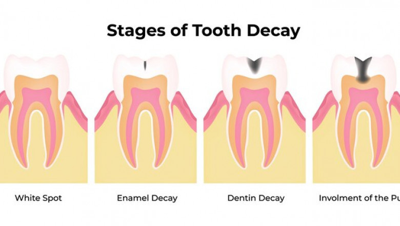 Tooth Regeneration Market Dynamic: Unveiling Cutting-Edge Dental Restoration Opportunities Ahead
