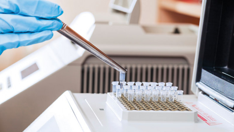 Unlocking Global SVT Market Size with Testing Share Growth and Industry Forecasts