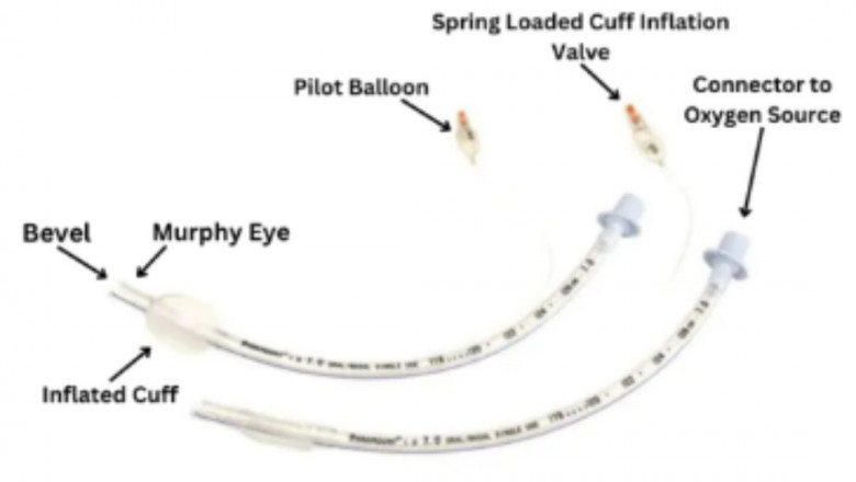 Cuffed Endotracheal Tube: A Guide To Secure Airway Management