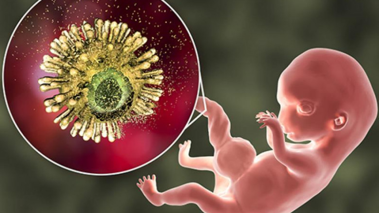 Cytomegalovirus (CMV) Infection Therapeutic Market to Grow via mRNA Vaccine Innovations
