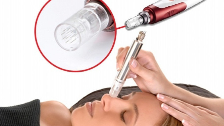 Dermapen: Natural Skin Enhancement
