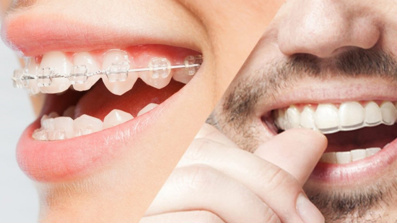 Radiant Smiles at Dental Associates of Delaware Newark