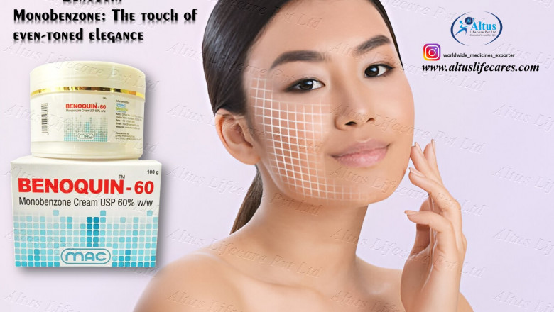 See How 60 Monobenzone Cream Changed Her Skin Forever!
