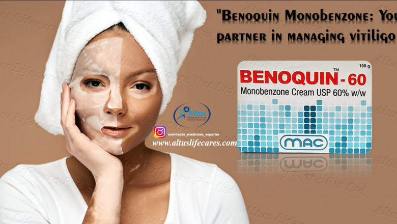 The Internet Is Obsessed with 60 Benoquin – Here’s Why Vitiligo Patients Are Talking!