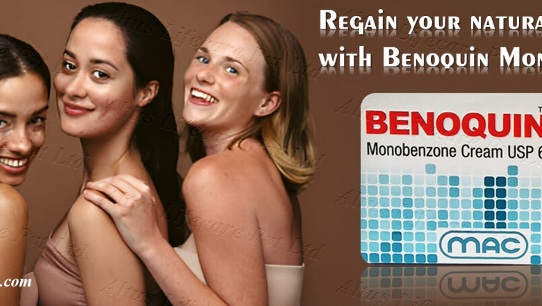 They Laughed at His Vitiligo… Until He Tried Benoquin Monobenzone 60 Cream!