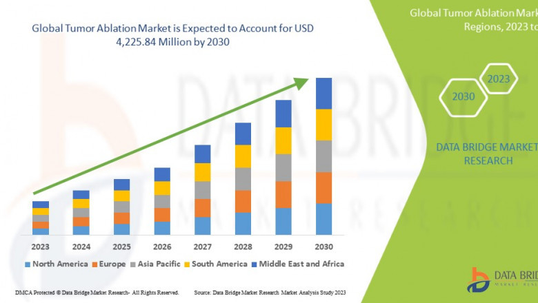 Tumor Ablation Global Market: Trends and Opportunities by 2025 - 2030