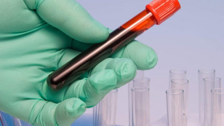 Unfractionated Heparin: A Comprehensive Guide to Its Uses, Benefits, and Precautions