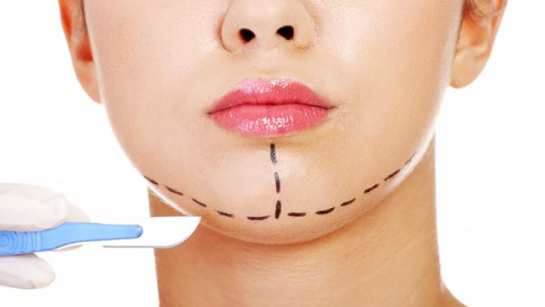 Your guide to post-chin reduction care in Riyadh clinics