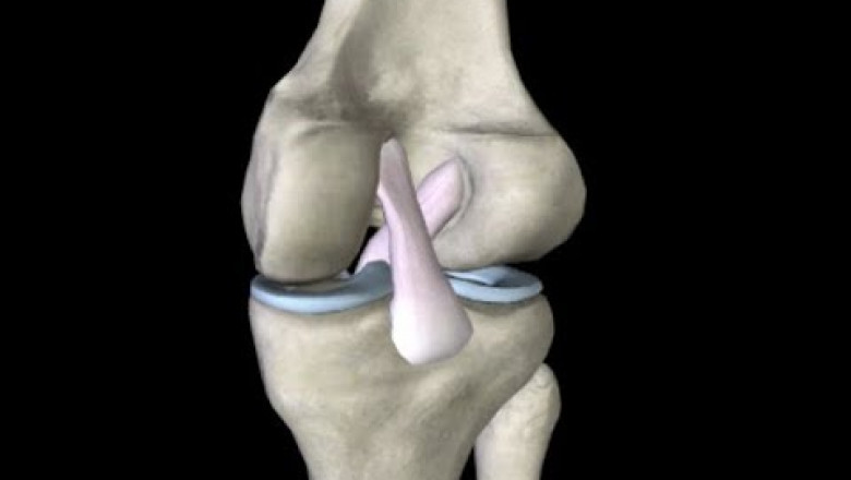 Anterior Cruciate Ligament Injuries Market to Grow Rapidly with Regenerative Therapies
