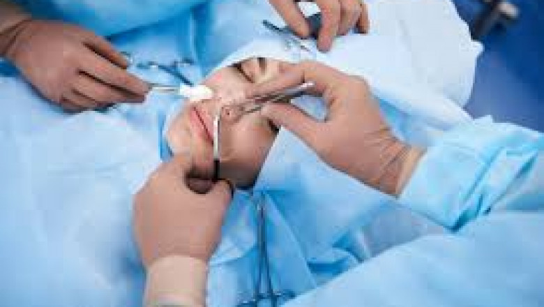 Balloon Sinuplasty Recovery Timeline: How Long Does It Take to Heal?