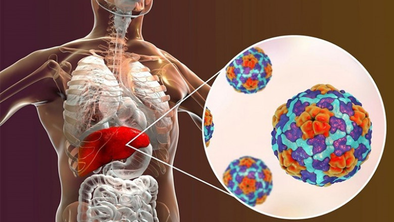 BK Virus (BKV) Infection Market Anticipated to Grow Owing to Escalating Transplant