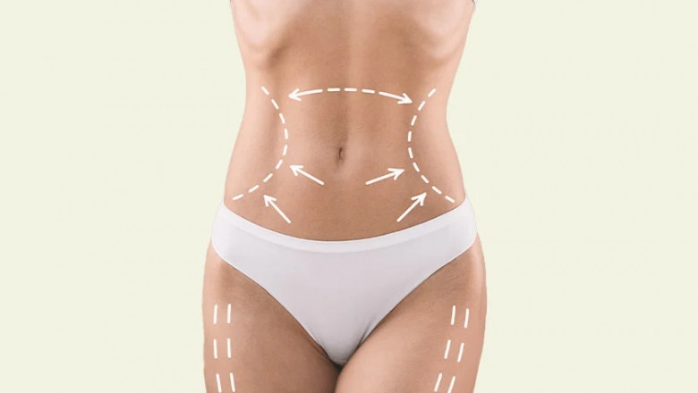 How to Verify Credentials of the Best Fat Transfer Surgeon in Dubai