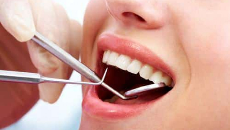 Limited-Time Teeth Cleaning Offers in Dubai Clinics