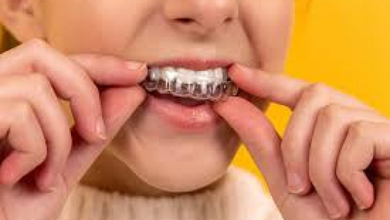Orthodontic Retainers Market product segmentation and demand trends in clear versus traditional retainers
