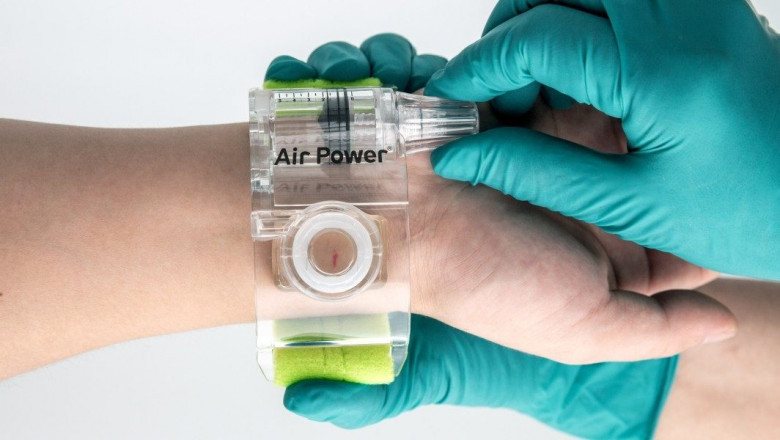 Radial Compression Devices Market Set to Grow with Automated Hemostasis Technology