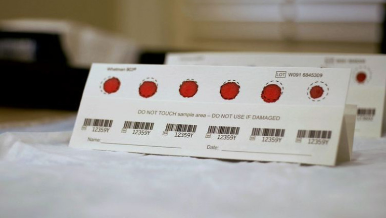 Specimen Collection Cards Market Expands Rapidly Amid Growing Demand for Remote Sample Collection Methods