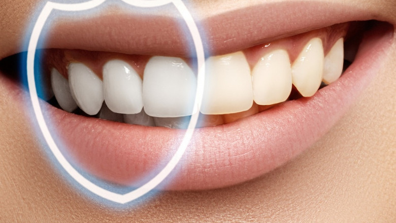 Teeth Desensitizer Market Gains Momentum Through Technological Advancements and Cosmetic Dental Procedures Boom