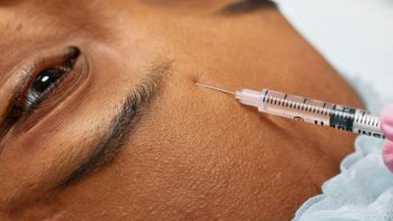 How Botox Can Help You Age Gracefully