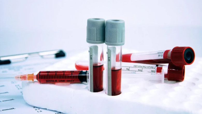 Are You Low on Vitamins? Blood Test at Home in Dubai Can Tell