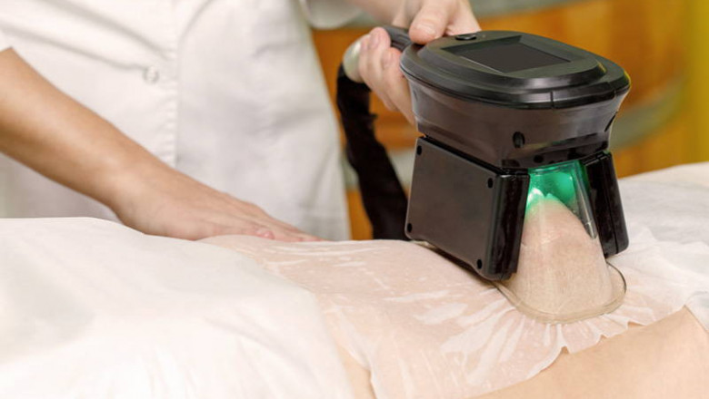 CoolSculpting Recovery: Tips to Help You Heal and Look Great