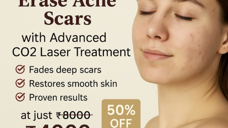 Discover the Best Skin Clinic in Adyar for Radiant Skin & Healthy Hair