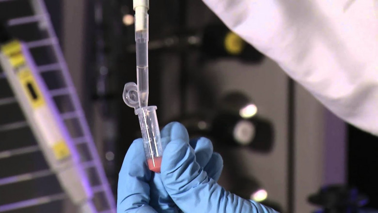 Drug Infusion System Market to Grow Owing to Chronic Disease Prevalence