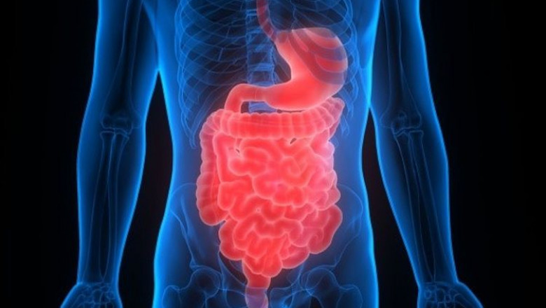 Malabsorption Syndrome Market Fuels Growth with Microbiome Therapies