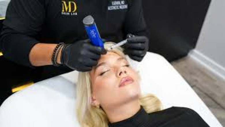 Best Microneedling Treatment in Canada