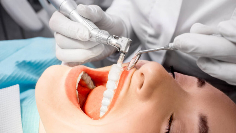 From Anxiety to Relief – My Affordable Teeth Cleaning Story in Dubai