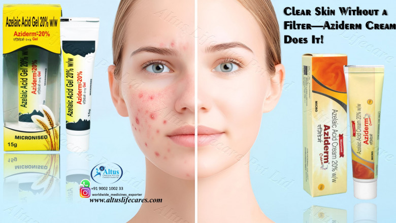 Azelaic Acid Cream: The Miracle Cure for Stubborn Skin Problems!