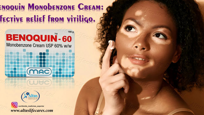 Everything You Need to Know About Benoquin 60% Cream